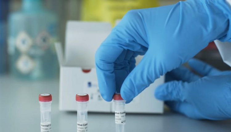 متحدہ عرب امارات میں کورونا وائرس ٹیسٹ کب اور کہاں کروانا چاہیئے