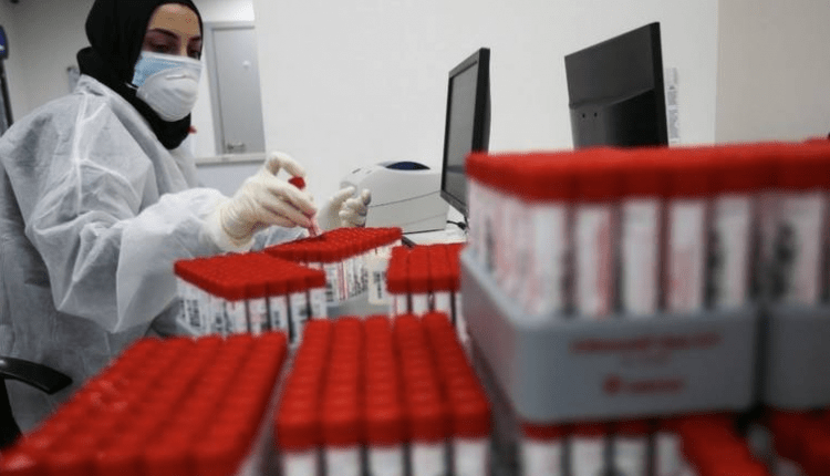 امارات کے تمام اسپتال ضروری طبی سامان سے آراستہ ہیں