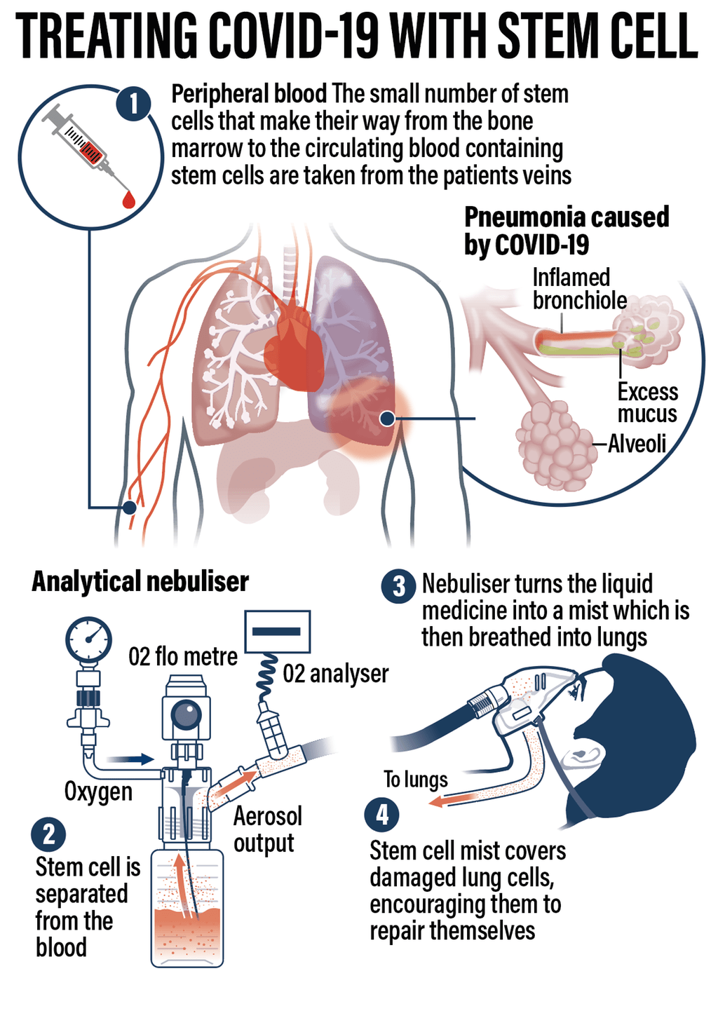 امارات کے اسٹیم سیل سنٹر نے کوویڈ ۔19 علاج کیلیے کامیاب ٹرائل کی تصدیق کردی ہے